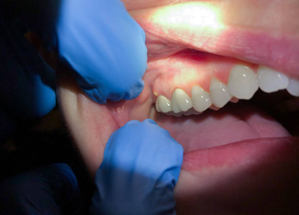  Mount Pleasant, NC Emergency Dentist Pros