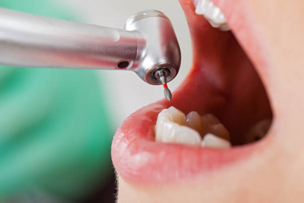 Best After-Hours Emergency Dentist in Mount Pleasant, NC
